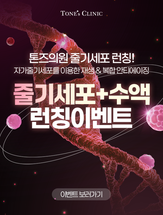 팝업